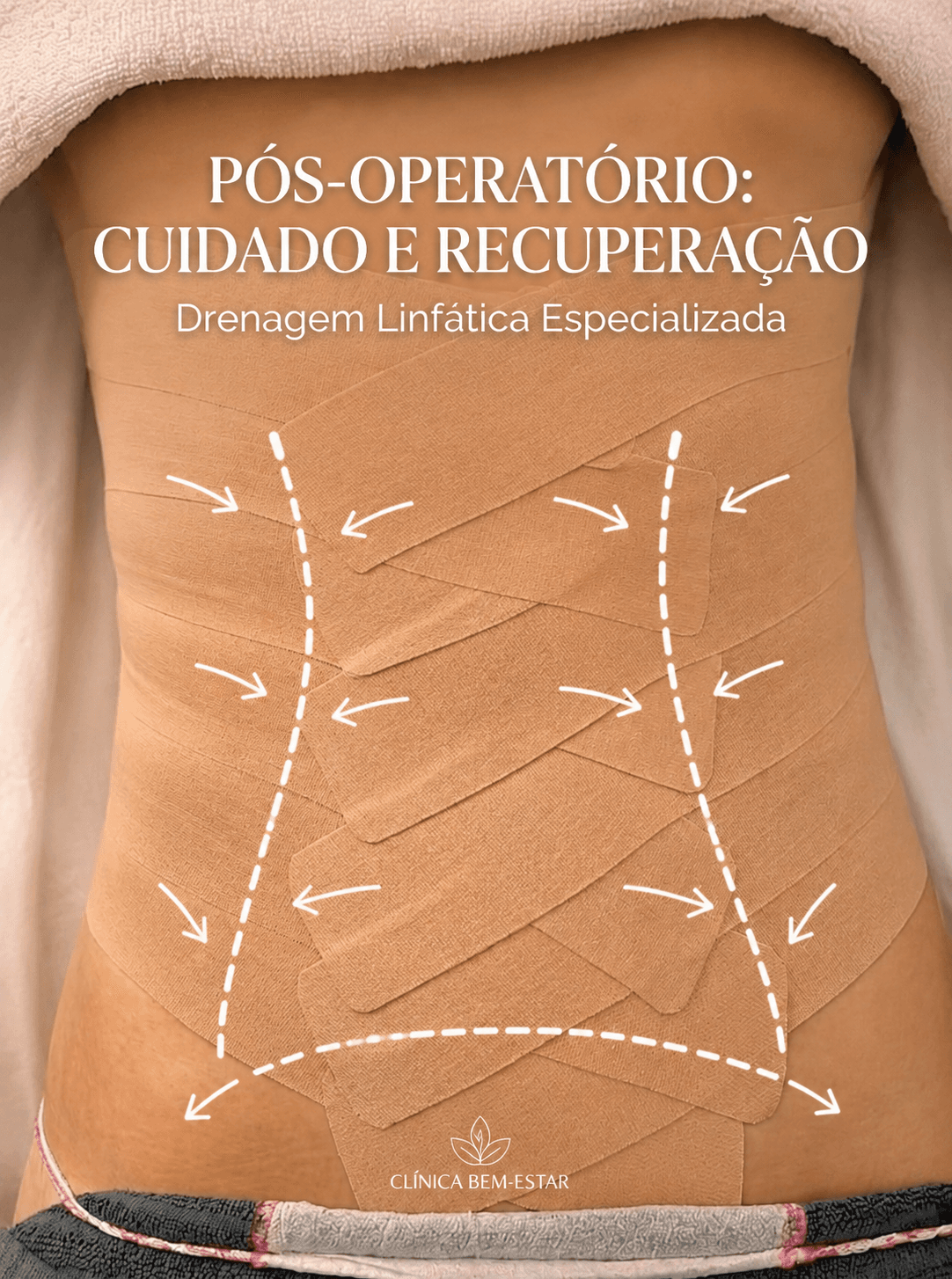 Drenagem Linfática Pós-Operatório
